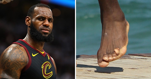 nba明星球鞋底下的痛. 詹皇露「扭曲脚趾」 粉丝惊:怎麼会这样?